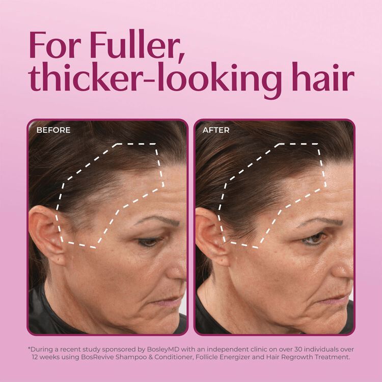 Women's Healthy Hair Thickening System