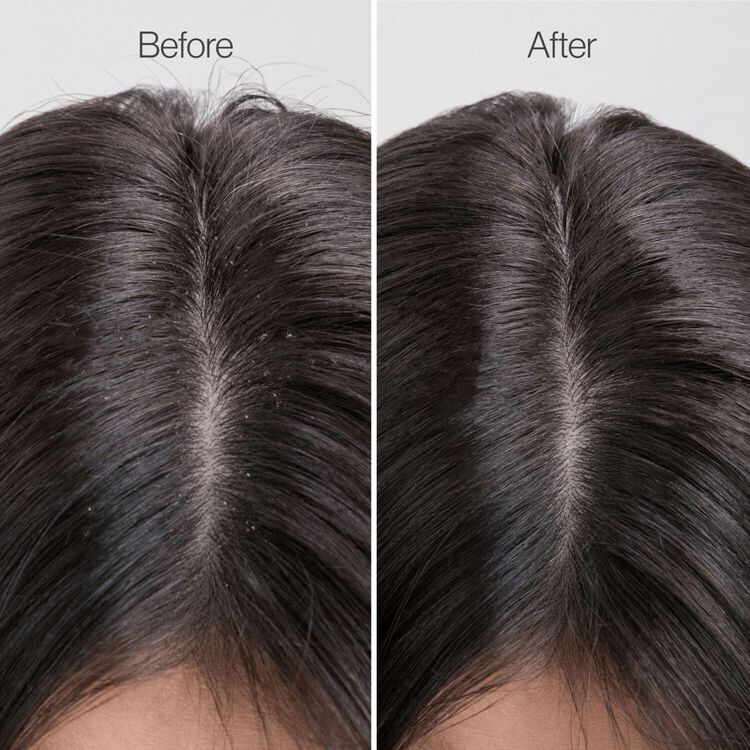 Clarifying ACV Rinse