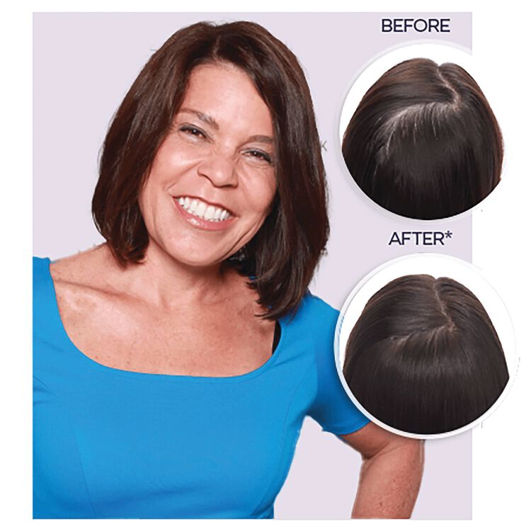 Hair Regrowth Treatment for Women