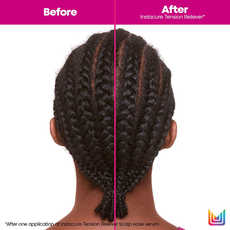 Instacure Tension Reliever