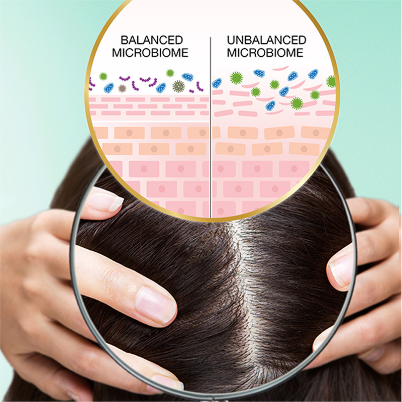 balanced microbiome vs unbalanced microbiome